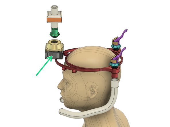 A fan draws room air through an anesthesia viral filter to fill the halo bag. Full mobility is possible with a 12 volt battery pack.