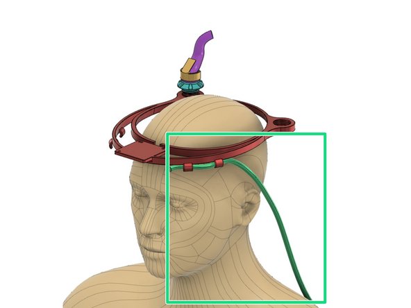 The Halo is a close-fit PAPR that provides virus-free air via an anesthesia ventilator virus filter.