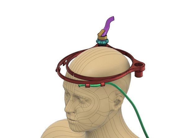 Simplest Halo configuration is for oxygen or medical air. This configuration uses the fewest consumables and is ideal for brief, aerosolizing procedures such as intubation or airway removal in a fixed location.