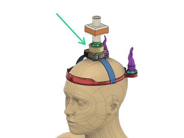 A fan draws room air through an anesthesia viral filter to fill the hood bag. Full mobility is possible with a 12 volt battery pack.