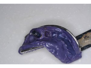 Biohorizon 5.0轉印螺絲裝置方法