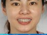 Lynx Smile 微笑設計軟體設計範例