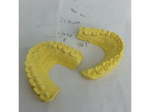 美白牙托不同類型與製作