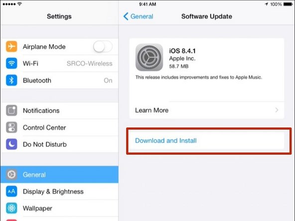 Click on the Download and install button.