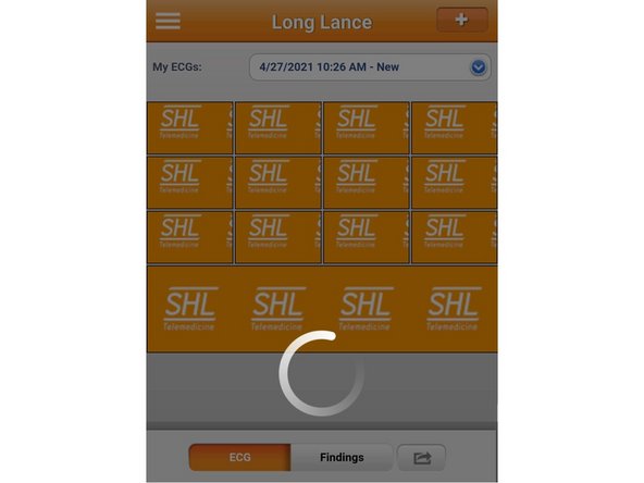 Wait a moment for the ECG report to generate.