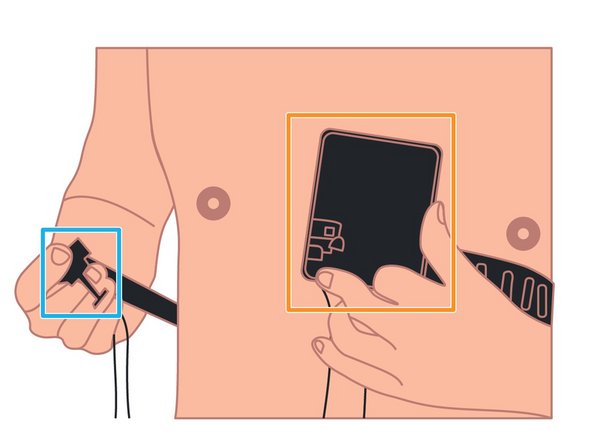 Center and hold the SmartHeart®  housing with your left hand