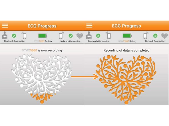 Relax while SmartHeart® is recording.