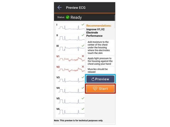 An ECG preview will take place.  This is a test to verify SmartHeart® is making proper contact to generate accurate readings.