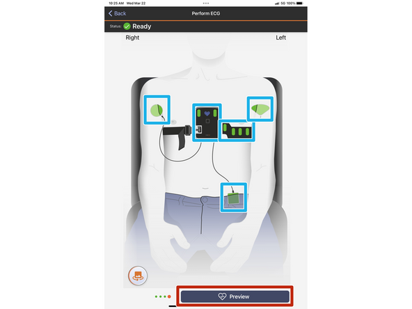 Each electrode will update in real time, the quality of the contact to your skin.