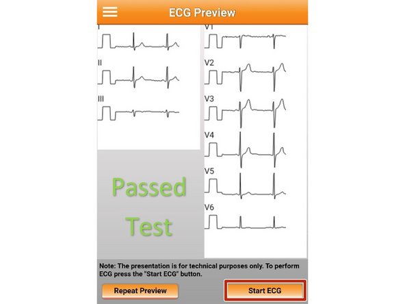 If your ECG preview was successful and does not have any notes: