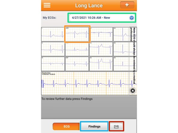 Your Current ECG will appear