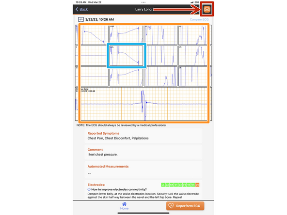 Wait a moment for the ECG report to generate.