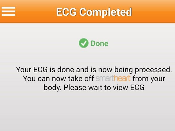 Once SmartHeart® is done recording it will  take a moment to process the recording.
