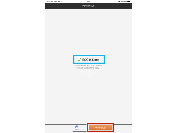 The SmartHeart® can be taken off