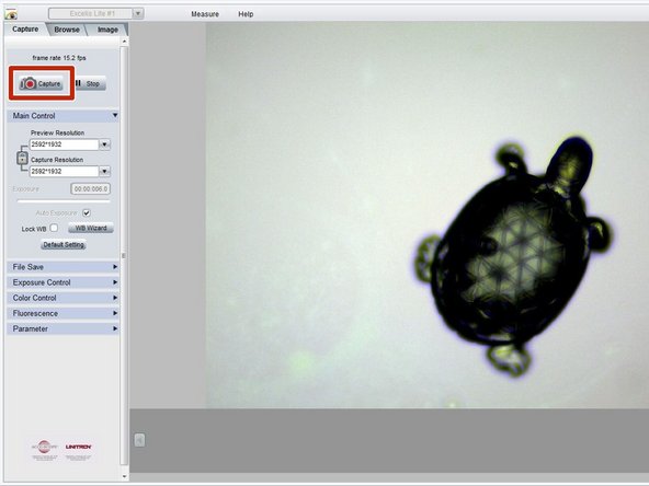 Adjust the focus of the microscope so you can clearly visualize the feature(s) of interest.