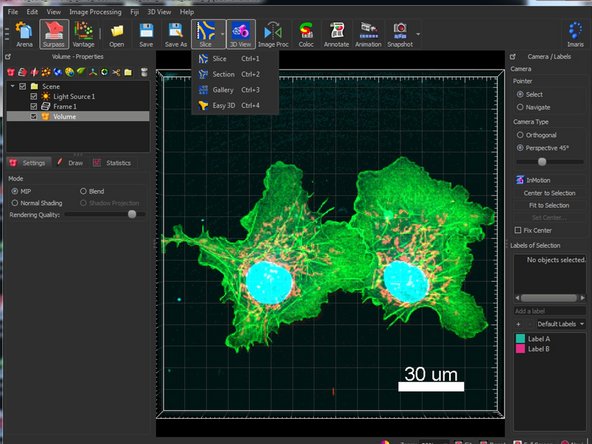 Explore the different slice image representations under the Slice icon such as the Section (Normally called ortho viewer).