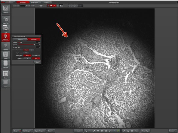 The shadow is blurry and not centered: The condenser is not focussed and the condensor aperture is not well aligned.