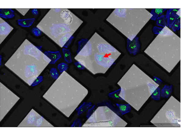 Either based on the fluorescent atlas image (previous step) or based on SEM atlas, select cells for milling.