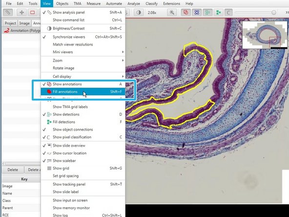 To redefine areas press &quot;Alt&quot; an drag around the area you would like to erase.