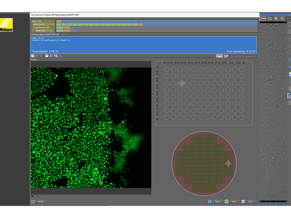 If your plate alignment, focus strategy does not work, changes in the JOB are possible. Please consult it with ZMB staff.