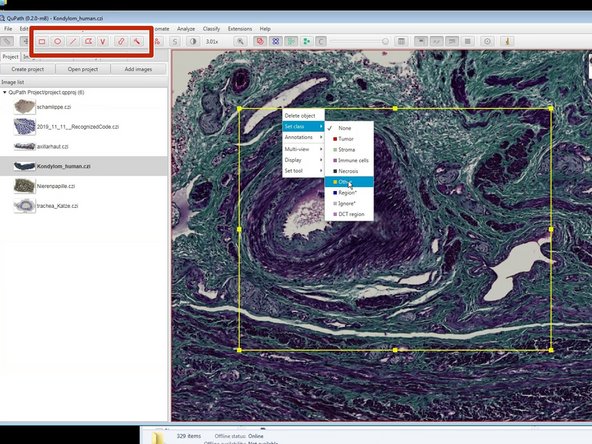 Using the indicated annotation tools you can annotate different regions of interest in your images.