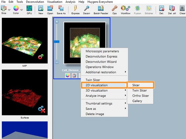 Right click on the thumbnail and &quot;2D visualization/Slicer&quot; opens the image in  a slicer view and allows you to check if the data was imported properly.