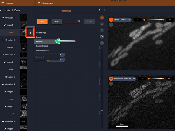 Open the data with Abberior Lightbox software.