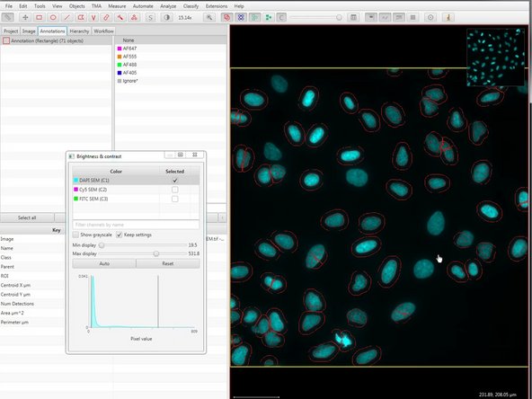 If you are not happy with the detection you can adjust the parameters and re-run the detection. (E.g. change  the intensity threshold, cell expansion, etc).