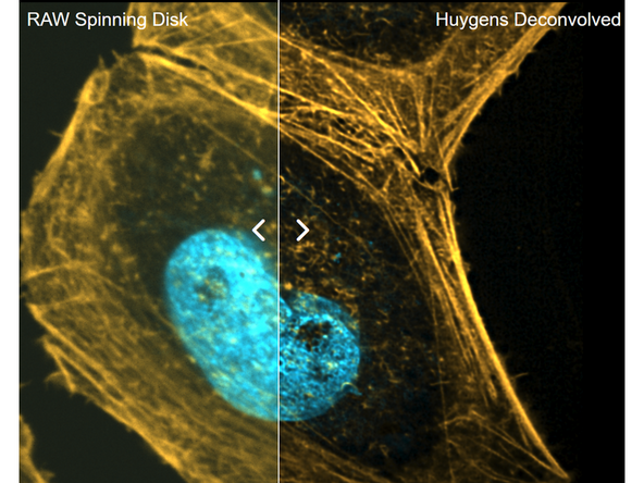 While spinning disk confocal imaging already provides good optical sectioning, additional deconvolution  can further reduce residual out-of-focus blur and improve contrast and resolution. See also: Image Deconvolution using SVI Huygens