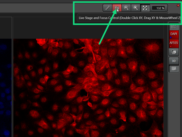 This feature is only available with the newest software version - currently (6.3.26) on the Stellaris Irchel and Stellaris USZ.