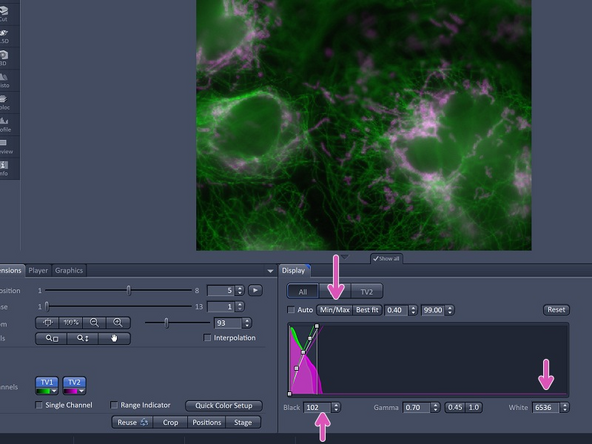 There is no universal law for choosing the best SIM² preset setting, however the following guideline might help. There are different SIM² preset settings accessible for either &quot;Live&quot; or &quot;Fixed&quot; samples. &quot;Weak, Standad and Strong&quot; refer to the iterative deconvolution step used in this type of processing.