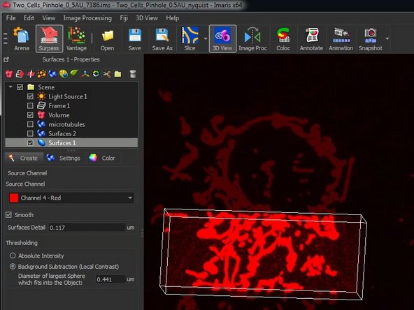 Choose if you want to apply a feature smoothing and/or an adaptive thresholding with a local background subtraction.