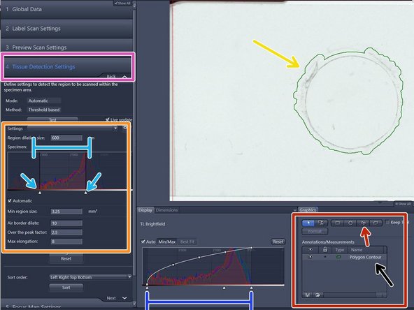 After the preview scan is finished you will be directed to the &quot;Tissue Detection Settings&quot; step.