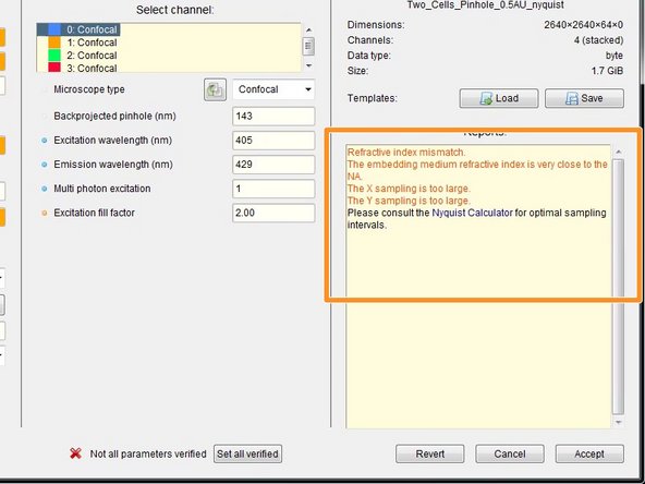 By the background color and in the &quot;Reports&quot; field, Huygens gives you feedback about issues with your imaging settings or parameters.