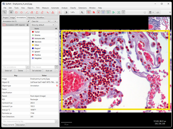 After it is done, segmented cells should appear in your annotation