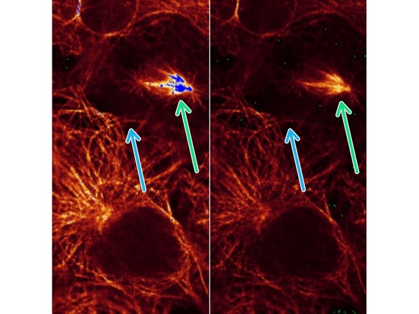 Example of microtubule staining recorded with different laser power