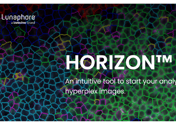 Review your data: Horizon Viewer or Horizon Software for analysis.