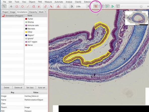 Fillings in annotations will allow you to highlight the selected area (Shift+F).