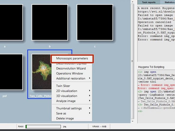 For a good deconvolution, correct  microscope, image and sample parameters are very important.