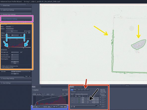 After the preview scan is finished you will be directed to the &quot;Tissue Detection Settings&quot; step.