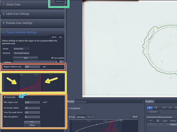 Deactivate &quot;Show All&quot; and  activate it again in order to see all options for the automatic tissue detection. (This is a software bug)