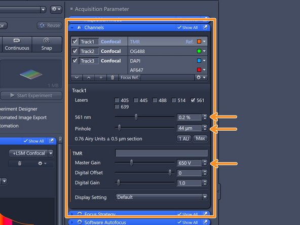 In the "Channels" box you can adjust the laser power, the diameter of the confocal pinhole as well as the detector master gain.