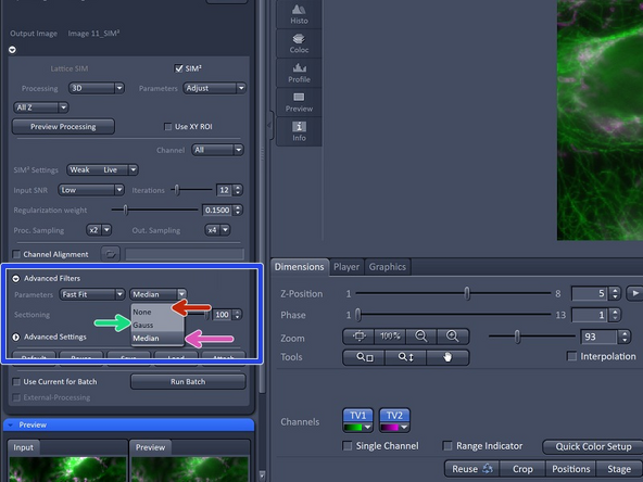 For Lattice SIM2 data one has the options for advanced filtering: