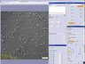 Olympus Spinning Disk - DIC images
