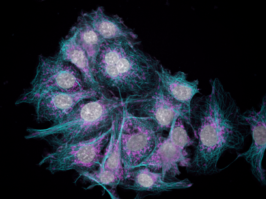 Nikon SD 3: Acquisition in XY and Z - ZMB UZH