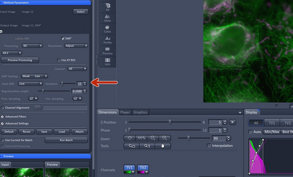 Iterations refers to the maximum number of loops / repeats for the iterative deconvolution. The number of iterations only mildly affects the outcome when changed moderately.