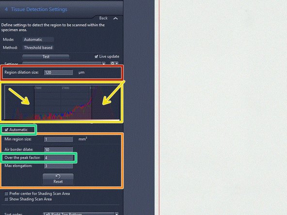 If necessary, change upper and lower intensity thresholds in the histogram in order to optimize the tissue detection.