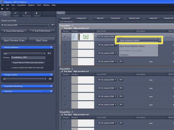 Select "Open advanced wizard" to access the wizard and to adjust scan parameters.