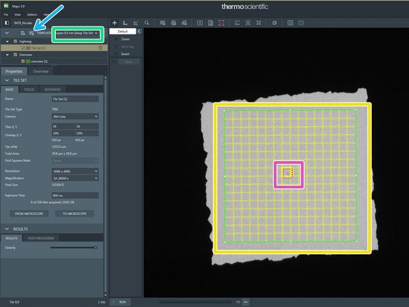 Press R1 on the right panel to insert the Flu screen (left screen)