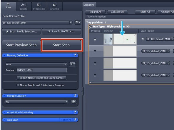 Once all parameters are adjusted, test the adapted scan profile on a small ROI. Note: a small ROI has to be manually defined in the &quot;Tissue Detection Settings&quot; step
